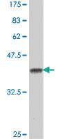 Anti-CHRNB4 Mouse Polyclonal Antibody