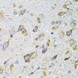 Immunohistochemistry analysis of paraffin-embedded mouse brain using Anti-ProDynorphin Antibody (A9754) at a dilution of 1:100 (40x lens). Perform microwave antigen retrieval with 10 mM PBS buffer pH 7.2 before commencing with IHC staining protocol