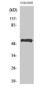 Western blot analysis of various cells using Anti-PRPF19 Antibody