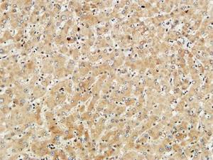 Immunohistochemical analysis of paraffin-embedded human liver using Anti-Met Antibody