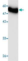 Anti-Listeria monocytogenes ActA Mouse Monoclonal Antibody [clone: 5a569]