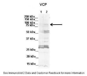 Anti-VCP Rabbit Polyclonal Antibody