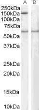 Anti-SIPA1 antibody