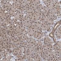 Anti-CCDC152 Rabbit Polyclonal Antibody