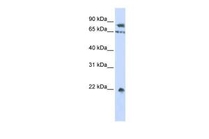 Anti-SENP1 Rabbit Polyclonal Antibody