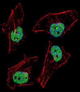 Anti-NFYB Rabbit Polyclonal Antibody (AP (Alkaline Phosphatase))