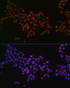 Immunofluorescence analysis of HeLa cells using Anti-GRB2 Antibody [ARC0430] (A309206) at a dilution of 1:100 (40x lens). DAPI was used to stain the cell nuclei (blue)