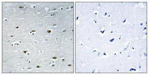 Immunohistochemical analysis of paraffin-embedded human brain using Anti-PRPF19 Antibody 1:100 (4°C overnight). The right hand panel represents a negative control, where the antibody was pre-incubated with the immunising peptide