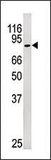 Anti-VSNL1 Rabbit Polyclonal Antibody