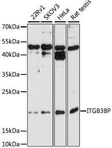 Western blot analysis of extracts of various cell lines, using Anti-ITGB3BP Antibody (A9755) at 1:1,000 dilution