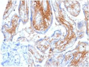 Immunohistochemical analysis of formalin-fixed, paraffin-embedded human placenta tissue using Anti-Decorin Antibody [DCN/6289] at 2 µg/ml Inset: PBS instead of the primary antibody Secondary antibody negative control