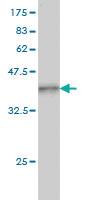 Anti-PLA2G4A Mouse Monoclonal Antibody [clone: 10G5]