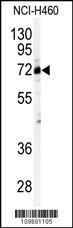 Anti-Cleavage Stimulation Factor 2 Rabbit Polyclonal Antibody (AP (Alkaline Phosphatase))