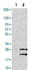 Anti-TGFA Rabbit Polyclonal Antibody