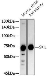 Western blot analysis of extracts of various cell lines, using Anti-SnoN / SNO Antibody (A9756) at 1:1,000 dilution. The secondary antibody was Goat Anti-Rabbit IgG H&L Antibody (HRP) at 1:10,000 dilution.