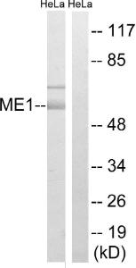 Western blot analysis of lysates from HeLa cells using Anti-ME1 Antibody. The right hand lane represents a negative control, where the Antibody is blocked by the immunising peptide