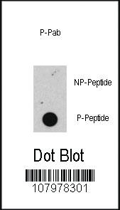 Anti-RB1 Rabbit Polyclonal Antibody