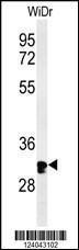 Anti-HCCS Rabbit Polyclonal Antibody (AP (Alkaline Phosphatase))