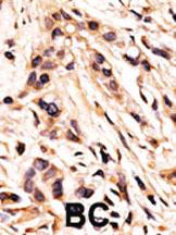 Anti-RB1 Rabbit Polyclonal Antibody