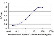 Anti-NPY Mouse Monoclonal Antibody [clone: 3F11]