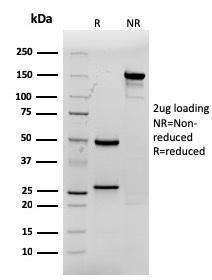 Antibody anti-CDX2 RCDX21690 100 µg