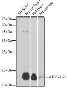 Western blot analysis of extracts of various cell lines, using Anti-ATP6V1G2 Antibody (A305403) at 1:1,000 dilution. The secondary antibody was Goat Anti-Rabbit IgG H&L Antibody (HRP) at 1:10,000 dilution.