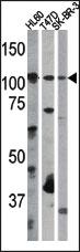 Anti-MED14 Rabbit Polyclonal Antibody