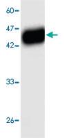 Anti-Hemolytic Streptococcus SLO Mouse Monoclonal Antibody [clone: 8t6s4]