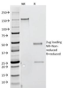 SDS-PAGE analysis of Anti-Interferon gamma Antibody [G-23] under non-reduced and reduced conditions; showing intact IgG and intact heavy and light chains, respectively SDS-PAGE analysis confirms the integrity and purity of the antibody