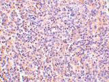 Anti-IL27RA Rabbit Polyclonal Antibody