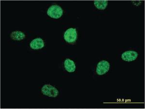 Anti-MIPOL1 Mouse Monoclonal Antibody [clone: 1B7]