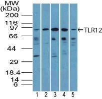 Anti-TLR12 Rabbit Polyclonal Antibody