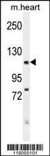 Anti-FBXO18 Rabbit Polyclonal Antibody (FITC (Fluorescein Isothiocyanate))