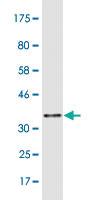 Anti-SYNE1 Mouse Monoclonal Antibody [clone: 4C3]