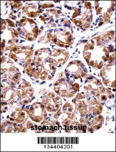 Anti-POLI Rabbit Polyclonal Antibody (Biotin)