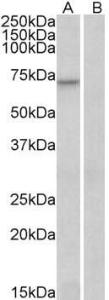 Anti-FOXO3 Antibody (A83729) staining (0.3 µg/ml) of Human Heart lysate (RIPA buffer, 35 µg total protein per lane). Primary incubated for 1 hour.