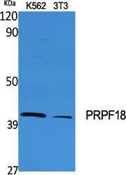 Western blot analysis of various cells using Anti-PRPF18 Antibody