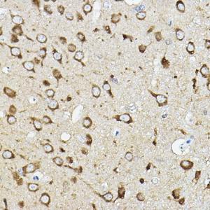 Immunohistochemistry analysis of paraffin-embedded rat brain using Anti-ATP6V1G2 Antibody (A305403) at a dilution of 1:50 (40x lens). Perform high pressure antigen retrieval with 10 mM citrate buffer pH 6.0 before commencing with IHC staining protocol.