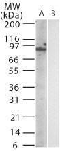 Anti-TLR12 Mouse Monoclonal Antibody [clone: 15F1215]