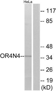 Western blot analysis of lysates from HeLa cells using Anti-OR4N4 Antibody. The right hand lane represents a negative control, where the Antibody is blocked by the immunising peptide