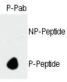 Anti-LUC7L Rabbit Polyclonal Antibody