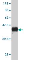 Anti-KSR1 Mouse Monoclonal Antibody [clone: 6C7]