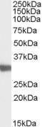 Anti-LDHC Antibody (A83730) (0.03µg/ml) staining of Mouse Testis lysate (35µg protein in RIPA buffer). Primary incubation was 1 hour. Detected by chemiluminescence.