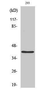 Western blot analysis of HuvEc cells using Anti-PRPF18 Antibody