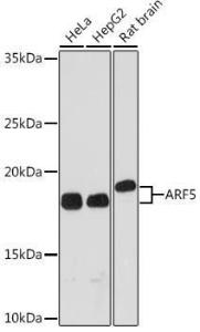 Western blot analysis of extracts of various cell lines, using Anti-ARF5 Antibody [ARC1960] (A309207) at 1:1,000 dilution The secondary antibody was Goat Anti-Rabbit IgG H&L Antibody (HRP) at 1:10,000 dilution Lysates/proteins were present at 25 µg per lane