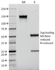 SDS-PAGE analysis of Anti-Kappa Light Chain Antibody [L1C1] under non-reduced and reduced conditions; showing intact IgG and intact heavy and light chains, respectively. SDS-PAGE analysis confirms the integrity and purity of the antibody