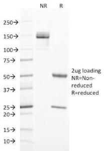 SDS-PAGE analysis of Anti-Cytokeratin 20 Antibody [SPM191] under non-reduced and reduced conditions; showing intact IgG and intact heavy and light chains, respectively. SDS-PAGE analysis confirms the integrity and purity of the antibody