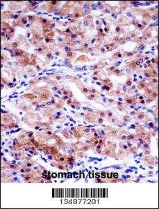 Anti-USP43 Rabbit Polyclonal Antibody (AP (Alkaline Phosphatase))