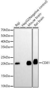 Western blot analysis of various lysates, using Anti-CD81 Antibody [ARC0615] (A306308) at 1:2,000 dilution