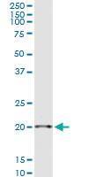 Anti-SAP18 Polyclonal Antibody Pair